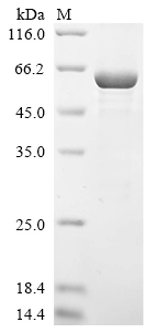 Recombinant Human Galectin-3-binding protein (LGALS3BP) (CSB-EP012888HU)