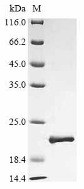 Recombinant Ailuropoda melanoleuca Fanconi-associated nuclease 1 (FAN1), partial (CSB-EP015179AYX)