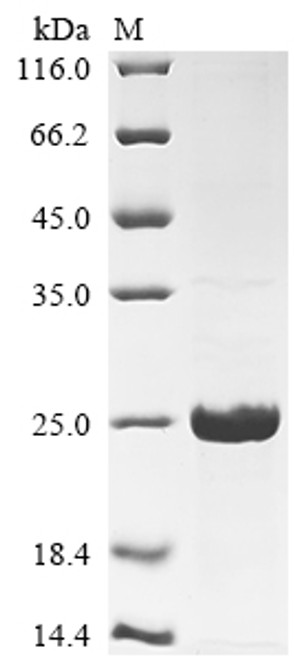 Recombinant Human Mucin-1 (MUC1) (CSB-EP015215HU)