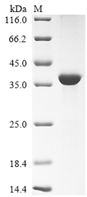 Recombinant Mouse Napsin-A (Napsa), partial (CSB-EP015452MO)