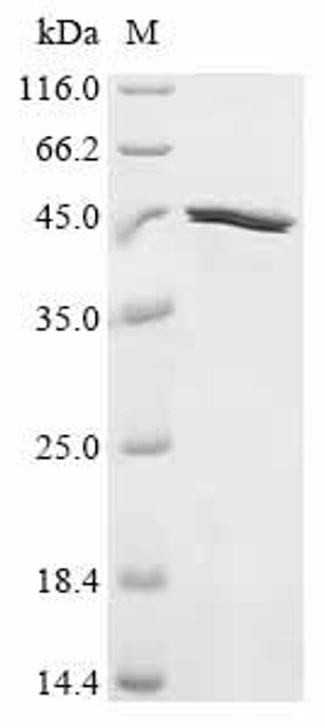 Recombinant Rat Neurofilament heavy polypeptide (Nefh), partial (CSB-EP015686RA)