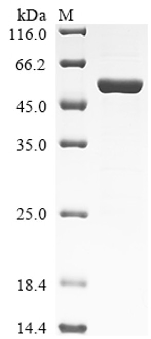 Recombinant Human Neurofilament light polypeptide (NEFL), partial (CSB-EP015688HU1)