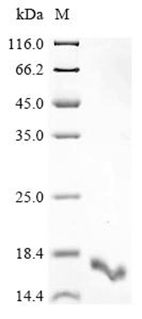 Recombinant Human P2Y purinoceptor 1 (P2RY1), partial (CSB-EP017326HU1) Recombinant Human P2Y purinoceptor 1 (P2RY1), partial (CSB-EP017326HU1)