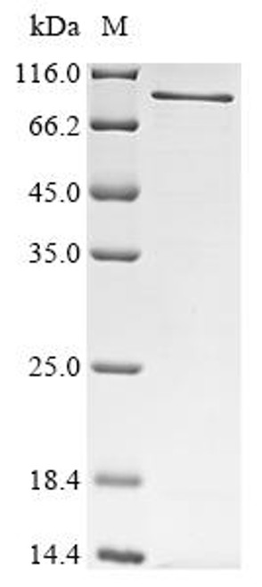 Recombinant Mouse Peroxisomal targeting signal 1 receptor (Pex5) (CSB-EP017805MO) Recombinant Mouse Peroxisomal targeting signal 1 receptor (Pex5) (CSB-EP017805MO)