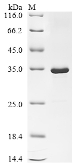 Recombinant Escherichia phage T7 T7 RNA polymerase (1), partial (CSB-EP018353EEB) Recombinant Escherichia phage T7 T7 RNA polymerase (1), partial (CSB-EP018353EEB)