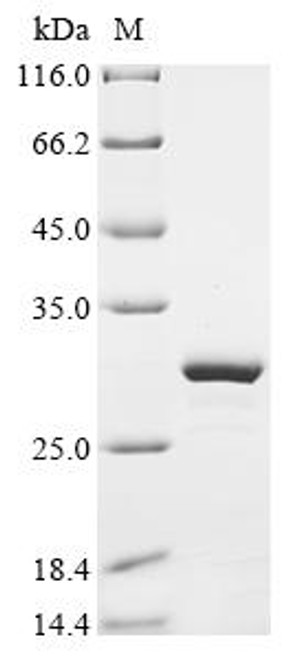 Recombinant Mouse Peptide YY (Pyy), partial (CSB-EP019128MO) Recombinant Mouse Peptide YY (Pyy), partial (CSB-EP019128MO)