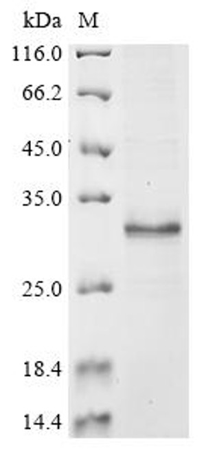 Recombinant Human Reduced folate transporter (SLC19A1), partial (CSB-EP021429HU) Recombinant Human Reduced folate transporter (SLC19A1), partial (CSB-EP021429HU)