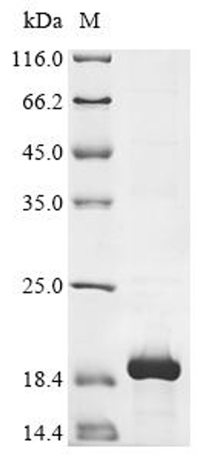 Recombinant Mouse Somatostatin (Sst), partial (CSB-EP022723MO)