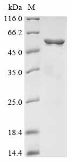 Recombinant Streptococcus agalactiae Group B streptococcal surface immunogenic protein (sip) (CSB-EP028046ZBP)