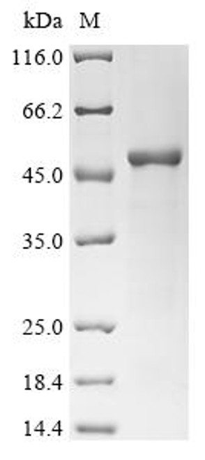 Recombinant Measles virus Fusion glycoprotein F0 (F), partial (CSB-EP301654MCQ) Recombinant Measles virus Fusion glycoprotein F0 (F), partial (CSB-EP301654MCQ)
