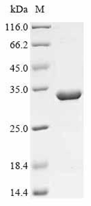 Recombinant Vaccinia virus Scaffold protein D13 (D13L), partial (CSB-EP303888VAA)