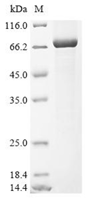 Recombinant Human Serine protease 56 (PRSS56) (CSB-EP317372HU)