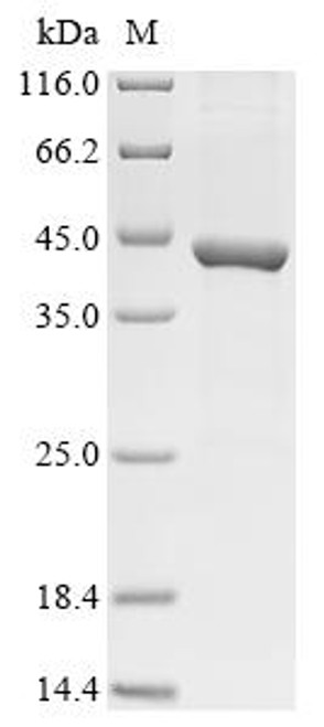 Recombinant Human rhinovirus 1B Genome polyprotein, partial (CSB-EP320160HQB)