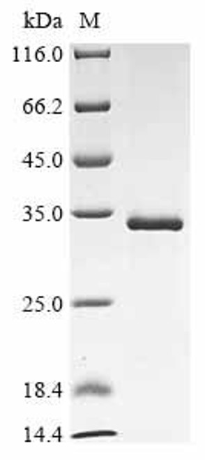 Recombinant Bovine leukemia virus Envelope glycoprotein (env), partial (CSB-EP326185BKF)