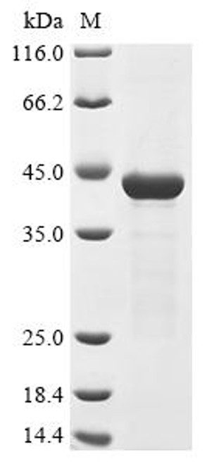Recombinant Salmonella typhimurium Type 1 fimbrin D-mannose specific adhesin (fimH) (CSB-EP334339SXB)