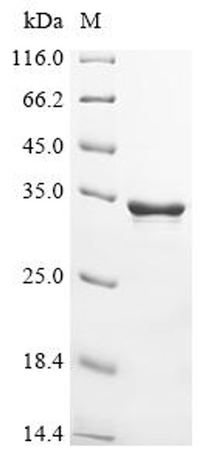 Recombinant Abrus precatorius Abrin-c, partial (CSB-EP340994AAC)