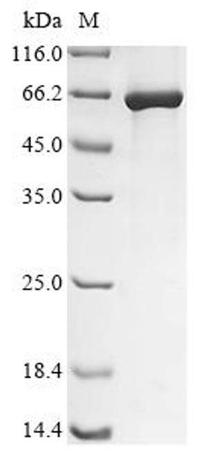 Recombinant Human adenovirus C serotype 5 Early E1A protein (CSB-EP355994HIL)