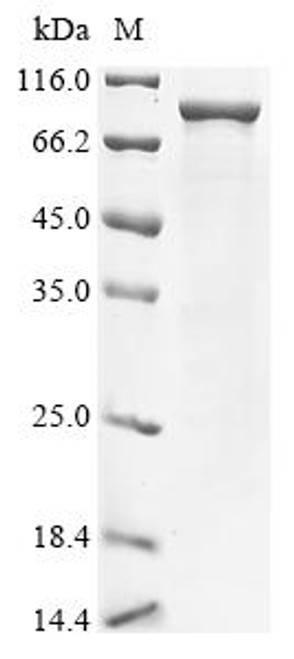 Recombinant Escherichia coli Bifunctional (p)ppGpp synthase/hydrolase SpoT(spoT) (CSB-EP360359ENV)