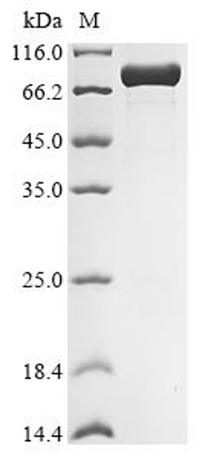 Recombinant Human cytomegalovirus Large structural phosphoprotein (UL32), partial, Biotinylated (CSB-EP362387HWV-B)