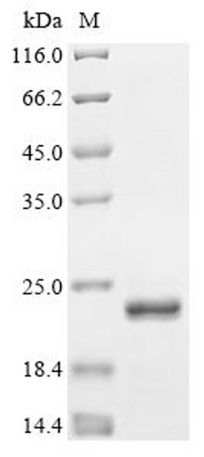 Recombinant Human immunodeficiency virus 1 Protein Rev (rev) (CSB-EP4507GJP)
