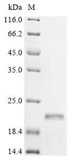Recombinant Human immunodeficiency virus 1 Protein Rev (rev) (CSB-EP4509GJP)