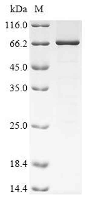 Recombinant Rat Coagulation factor XI (F11) (CSB-EP4522RA)