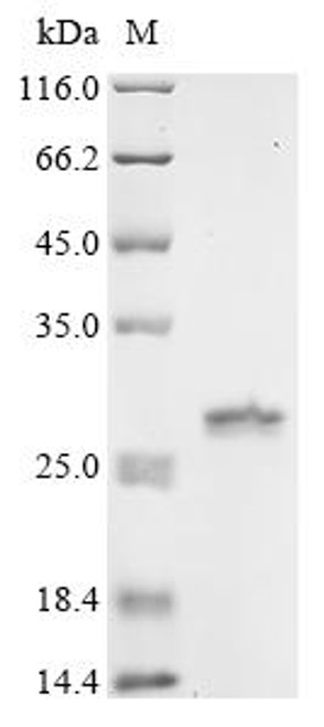 Recombinant Mycobacterium tuberculosis Conserved protein (Rv3304) (CSB-EP4589FSG)