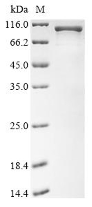 Recombinant Angiostrongylus cantonensis Galectin (CSB-EP4597GSO)