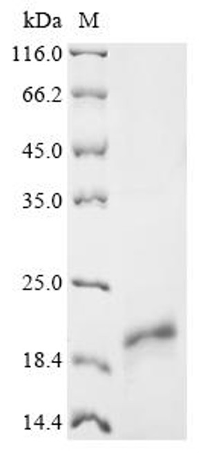 Recombinant Human immunodeficiency virus type 1 Protein Tat (tat) (CSB-EP4614GJP)