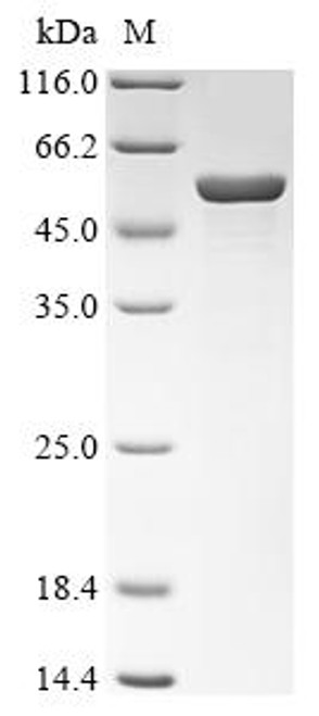 Recombinant Pyrococcus horikoshii Glycerate 2-kinase (gck) (CSB-EP530036FHX)