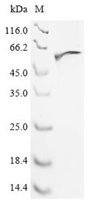 Recombinant Aspergillus phoenicis Mannosyl-oligosaccharide alpha-1,2-mannosidase 1B (mns1B) (CSB-EP613246APR)