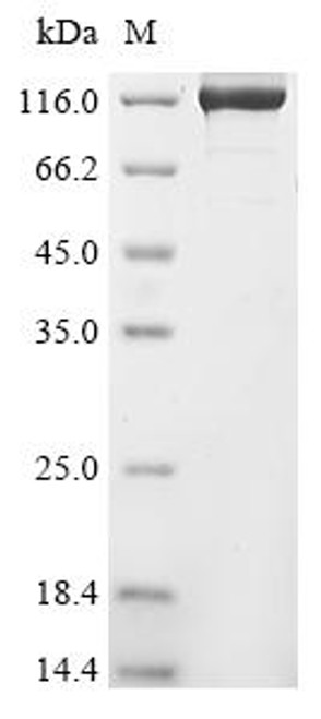 Recombinant Human Origin recognition complex subunit 1 (ORC1) (CSB-EP621667HU(A4))