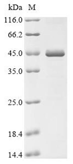 Recombinant Chlamydophila felis tRNA uridine (34) hydroxylase (trhO) (CSB-EP636612CAAV)