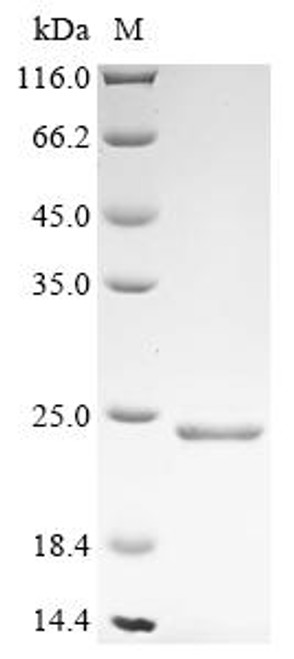 Recombinant Dog B-lymphocyte antigen CD20 (MS4A1), partial (CSB-EP661636DO1)