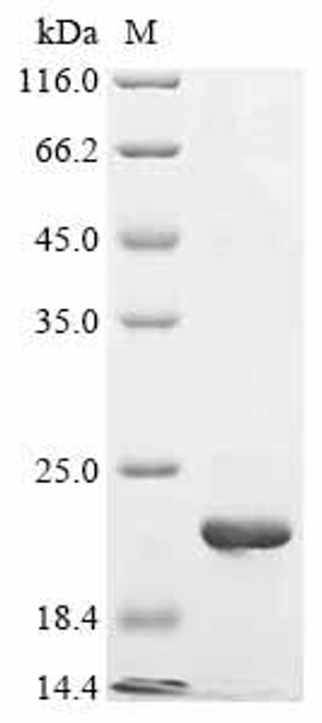 Recombinant Mouse Fanconi-associated nuclease 1 (Fan1), partial (CSB-EP734764MO)