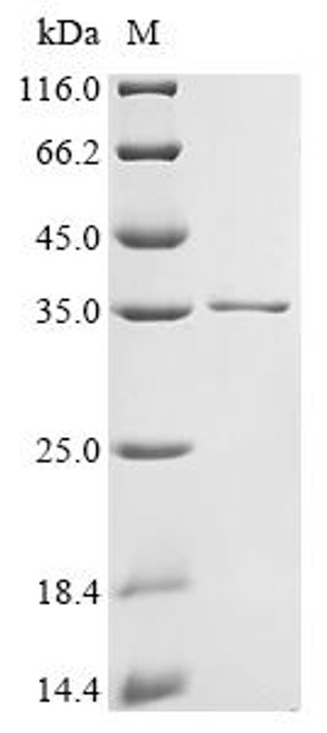 Recombinant Human Protein GPR107 (GPR107), partial (CSB-EP736202HU1)