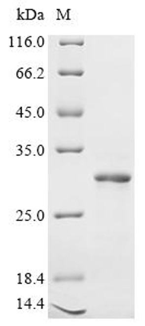 Recombinant Human Zinc transporter 10 (SLC30A10), partial (CSB-EP747695HU1)