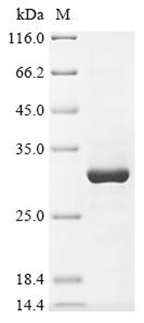 Recombinant Rat Transient receptor potential cation channel subfamily A member 1 (Trpa1), partial (CSB-EP764869RA)
