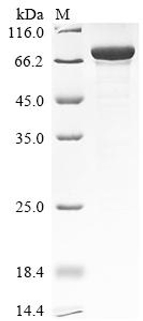 Recombinant Human N6-adenosine-methyltransferase catalytic subunit (METTL3) (CSB-EP773027HU)