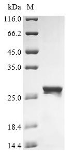 Recombinant Human UBA-like domain-containing protein 2 (UBALD2) (CSB-EP816915HU)