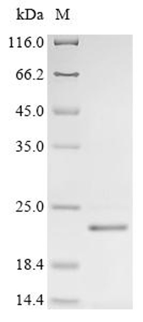 Recombinant Human Sodium/iodide cotransporter (SLC5A5), partial (CSB-EP835713HU)