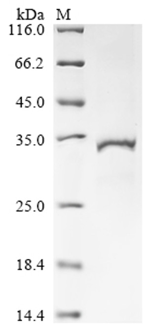 Recombinant Human Estradiol 17-beta-dehydrogenase 11 (HSD17B11) (CSB-EP843318HUb1)