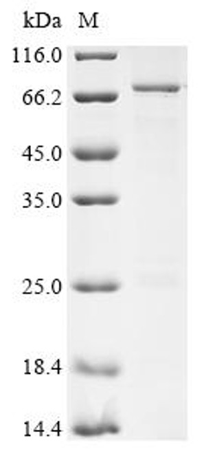 Recombinant Human Fermitin family homolog 2 (FERMT2) (CSB-EP853382HU)
