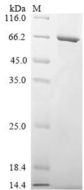 Recombinant Human Fc receptor-like protein 3 (FCRL3), partial (CSB-EP853475HU)