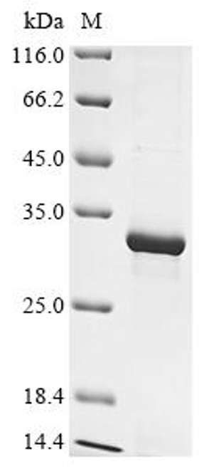 Recombinant Bovine Myosin-1 (MYH1), partial (CSB-EP858986BO)