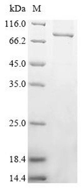 Recombinant Human Protein mono-ADP-ribosyltransferase PARP12 (PARP12) (CSB-EP875642HU)