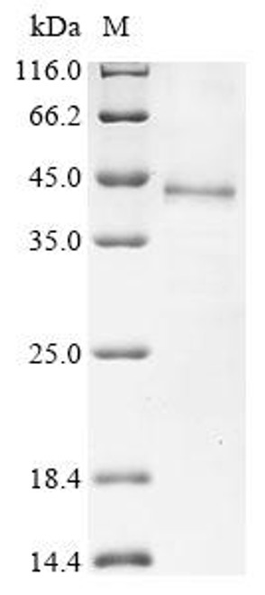 Recombinant Human Dipeptidase 1 (DPEP1) (CSB-YP007123HU)