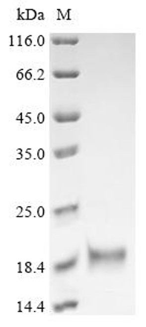 Recombinant Chicken Fibroblast growth factor 2 (FGF2) (CSB-YP008625CH)