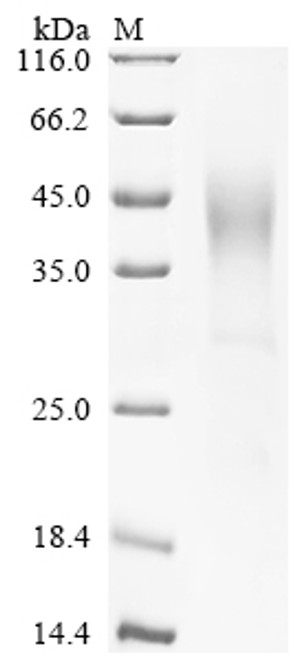 Recombinant Human Glucose-6-phosphatase (G6PC), partial (CSB-YP009118HU1a4)
