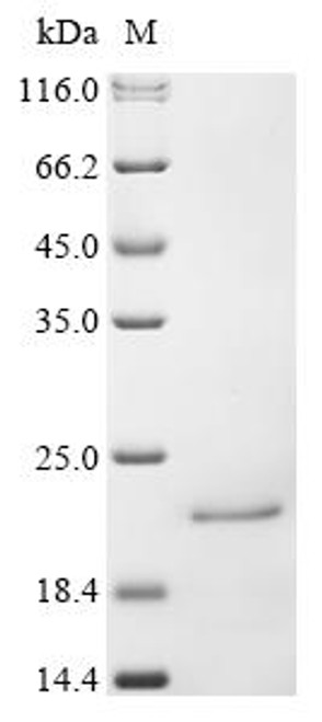 Recombinant Human Interferon alpha-16 (IFNA16) (CSB-YP011036HU)